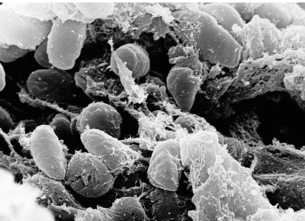 California Camper Contracts Plague After Possible Flea Bite, Officials Confirm