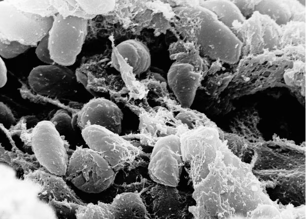 California Resident Tests Positive for Plague After Camping