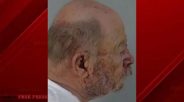 Florida Man Charged After Allegedly Shooting Woman, Then Beaten by Her Husband
